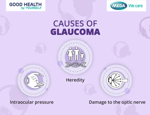 Causes of Glaucoma