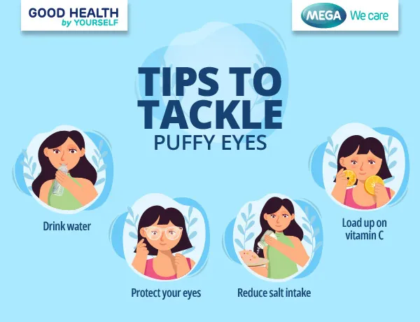 tips to tackle puffy eyes