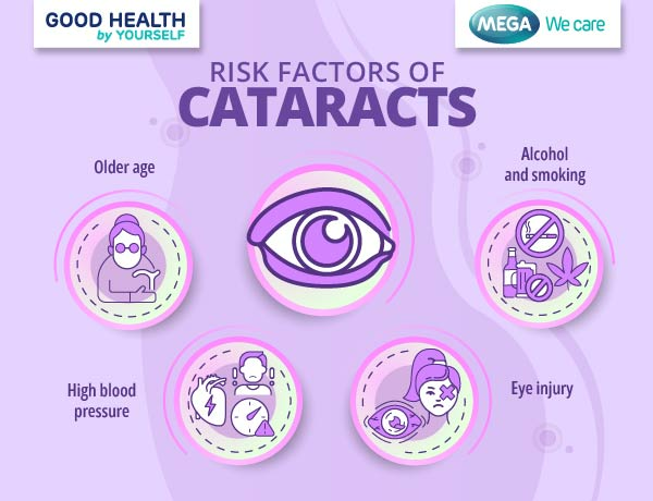 Risk factors of cataract